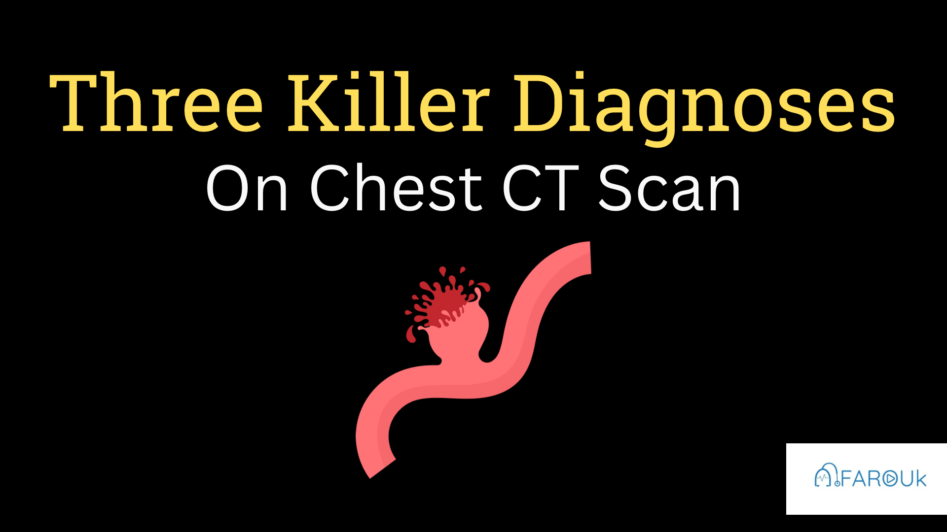 <h1><strong>The Three Killer Diagnoses on Chest CT Scans</strong></h1>