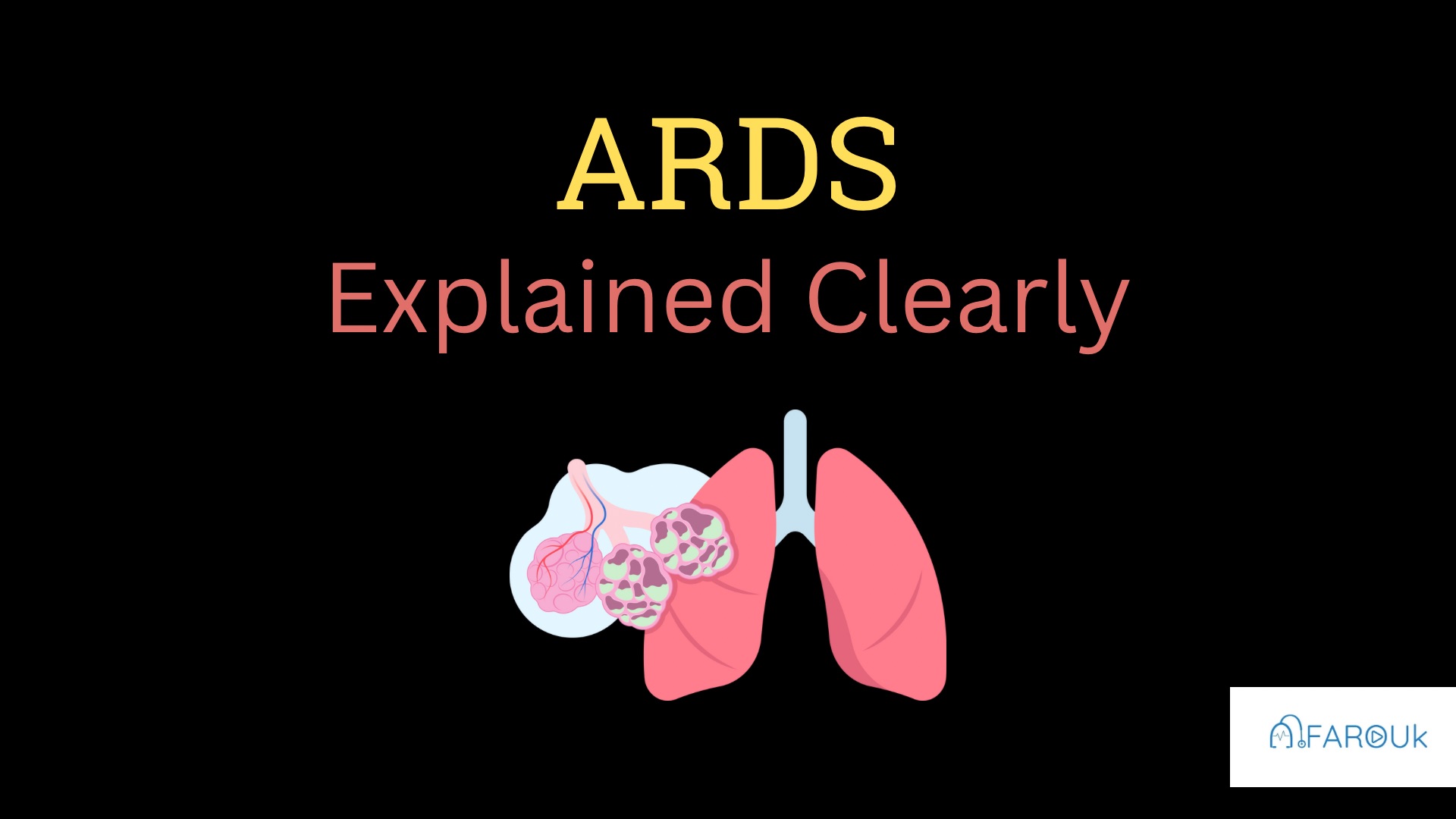 <h1><strong>Adult Respiratory Distress Syndrome</strong></h1>