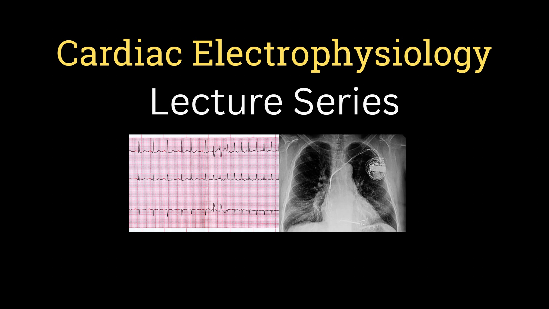 <h1><strong>Cardiac Electrophysiology Lecture Series</strong></h1>